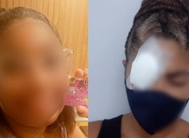 Arielle entrou em contato com água dois dias após usar o produto. | Foto: Arquivo pessoal