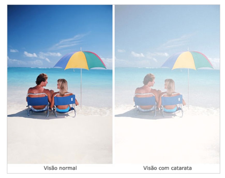 blog-image